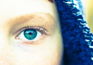 宝宝色素性毛表皮痣怎么治 宝宝色素性毛表皮痣怎么治